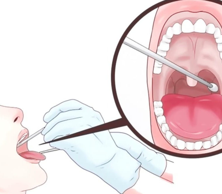 Τεστ Στρεπτοκόκκου (Streptest)